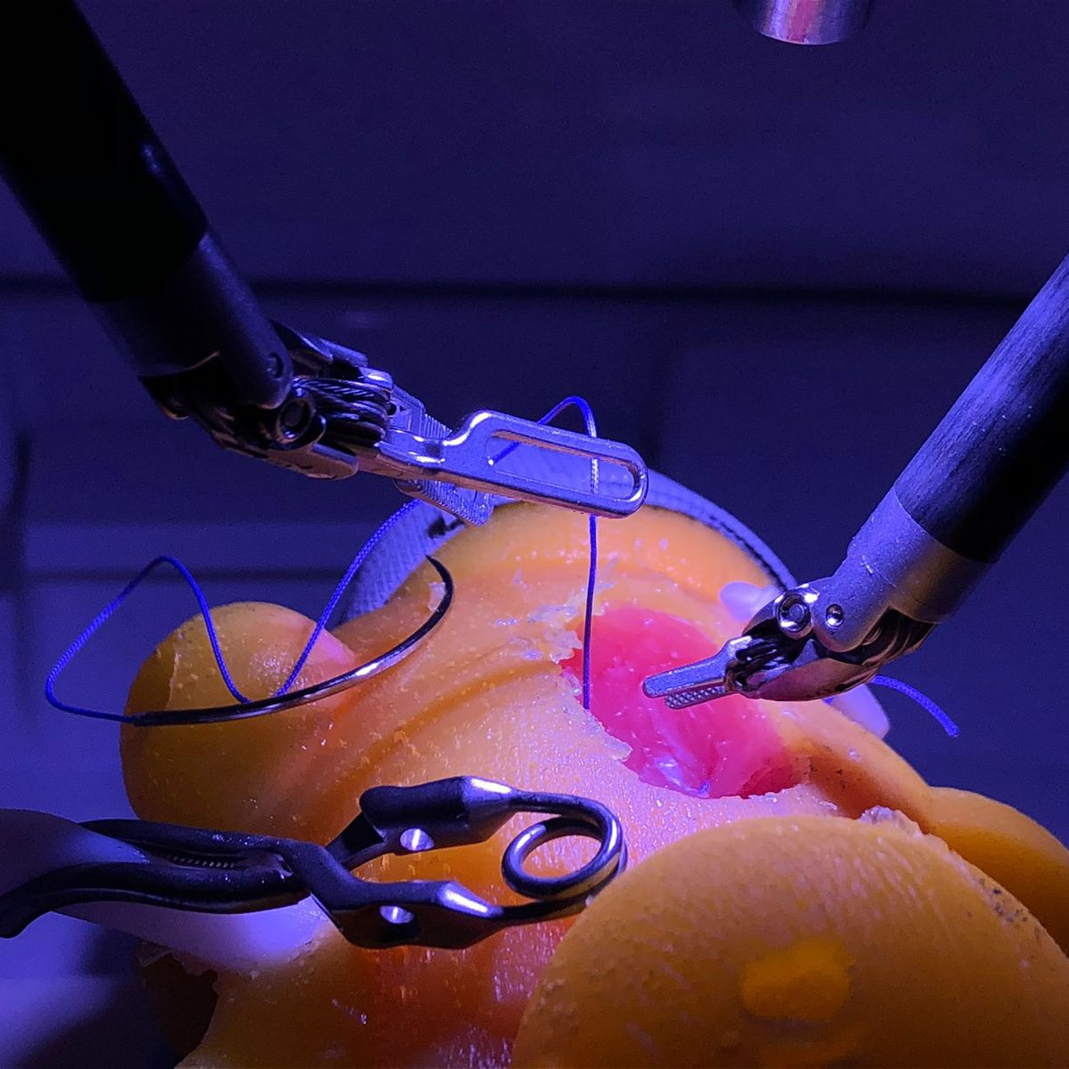 Kidney model - Partial Nephrectomy Simulator