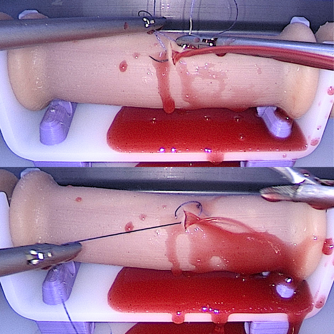 Urology Training - Major Vessel Injury Repair Model