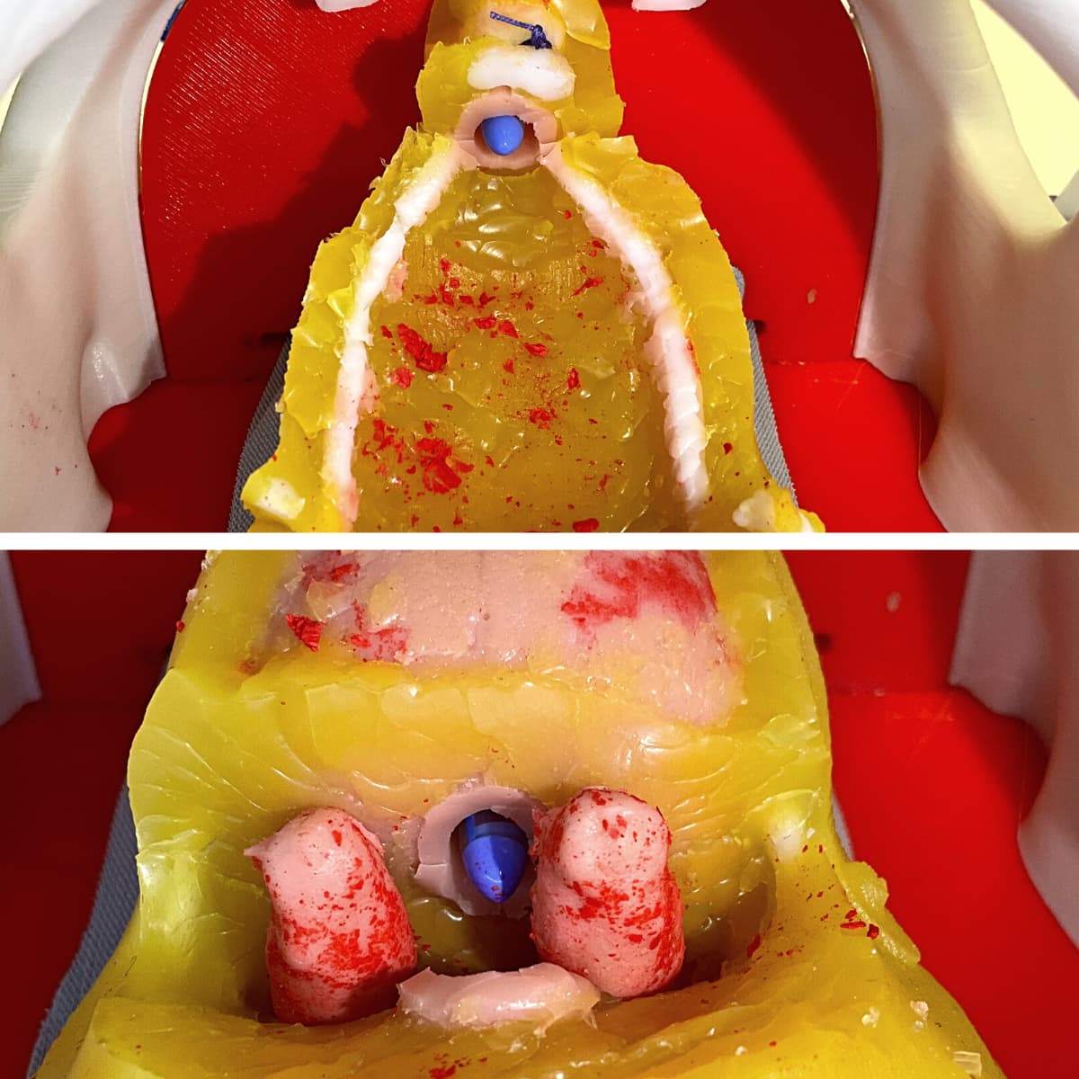 Prostate model - Radical Prostatectomy Simulator