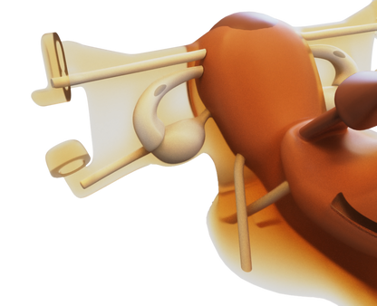 Gynecology training - Hysterectomy Simulator