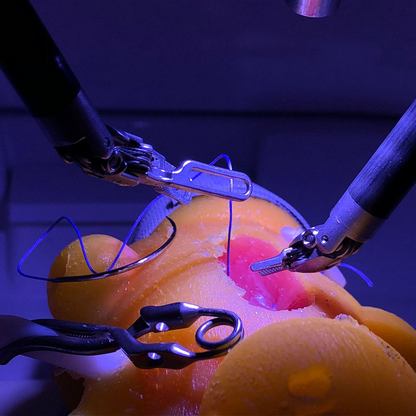 Kidney model - Partial Nephrectomy Simulator