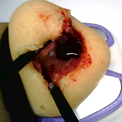 Perfused Model - Partial Nephrectomy Simulator