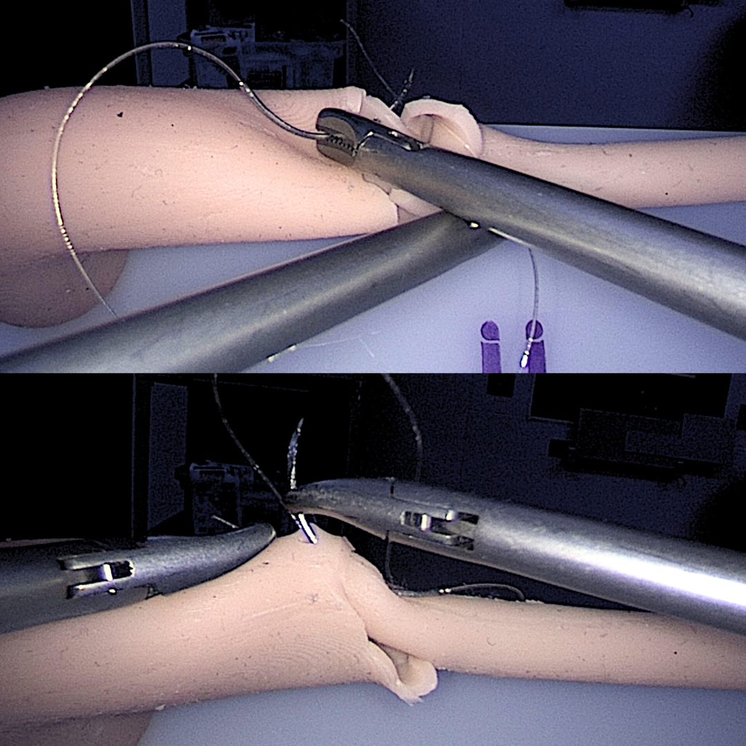 Urology Training - Pyeloplasty Model