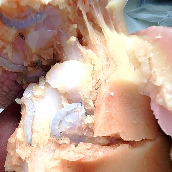 Thoracic Training - Lobectomy Model