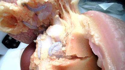Thoracic Training - Lobectomy Model