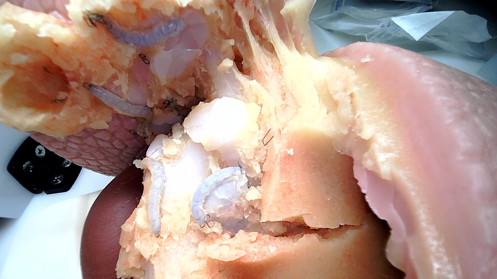 Thoracic Training - Lobectomy Model