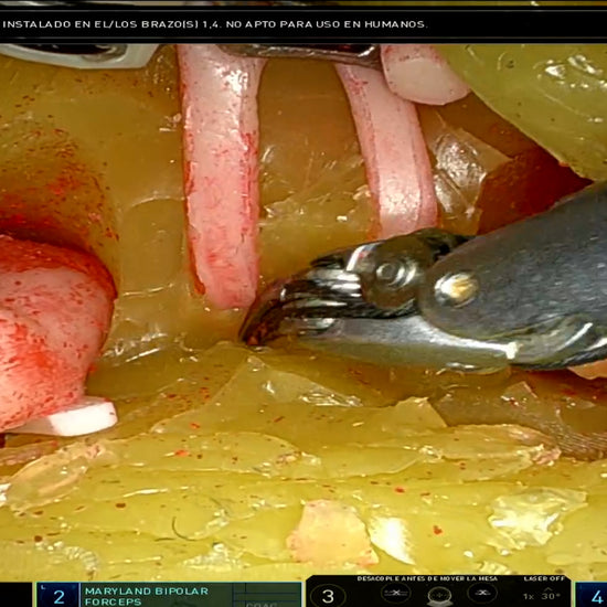 Retzius Sparing Radical Prostatectomy