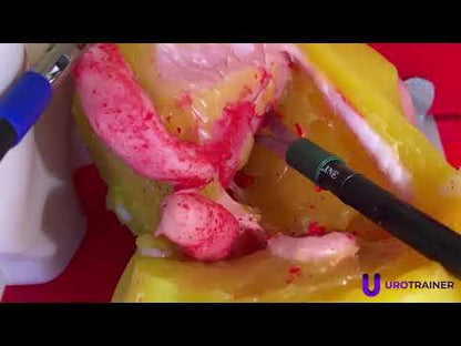 Prostate model - Radical Prostatectomy Simulator
