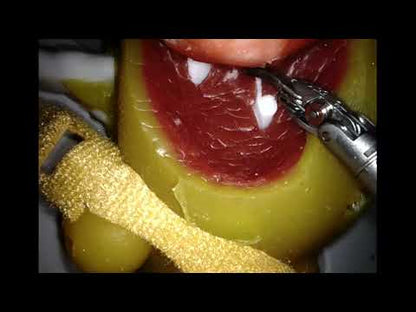 Kidney model - Partial Nephrectomy Simulator